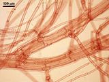 5 – Dettaglio delle pseudolaterali e delle cellule periassiali su cui si sovrappongono sparsi filamenti rizoidali discendenti